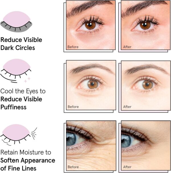 Limited Time Deal 44%OFF! grace & stella Under Eye Patches - Birthday Gifts