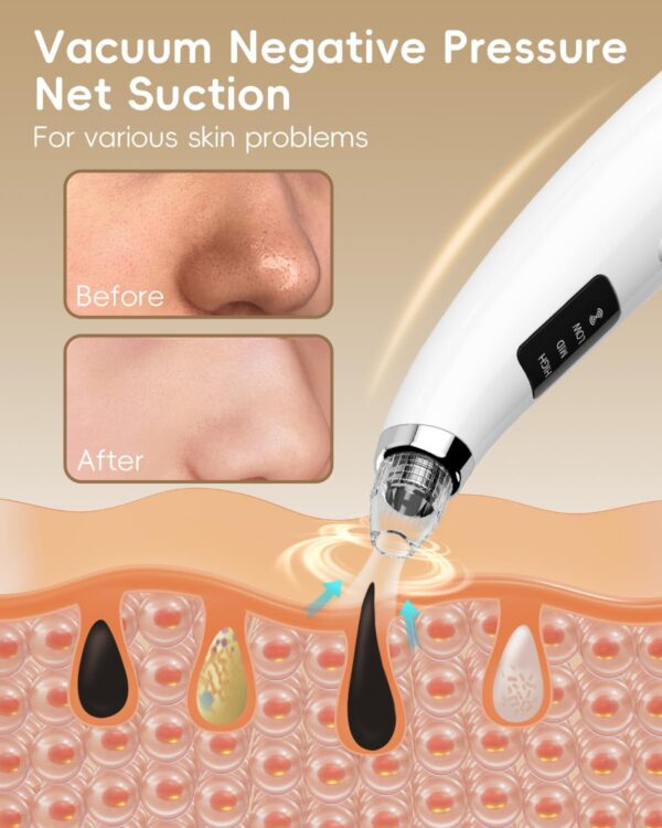 Limited Time Deal 63%OFF! Facial Pore Blackhead Remover Vacuum - Face Cleaner - Image 4