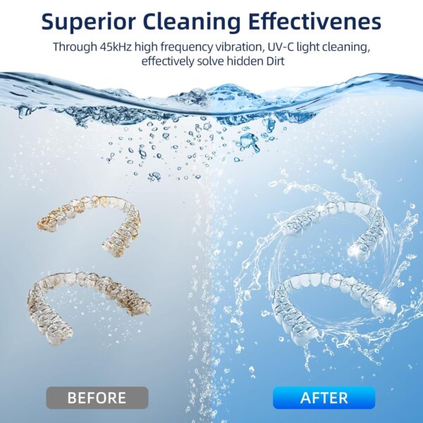 Limited Time Deal 33%OFF! Ultrasonic Retainer Cleaner, Retainer Cleaner Machine - Image 3