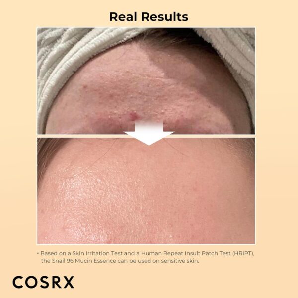 Limited Time Deal 36%OFF! COSRX Snail Mucin 96% Power Repairing Essence - Image 3