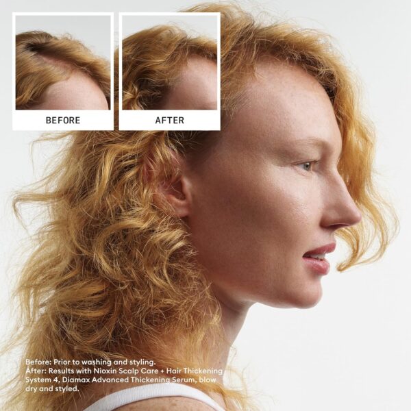 Limited Time Deal 50%OFF! Nioxin Scalp + Hair Thickening System Kits - Image 4