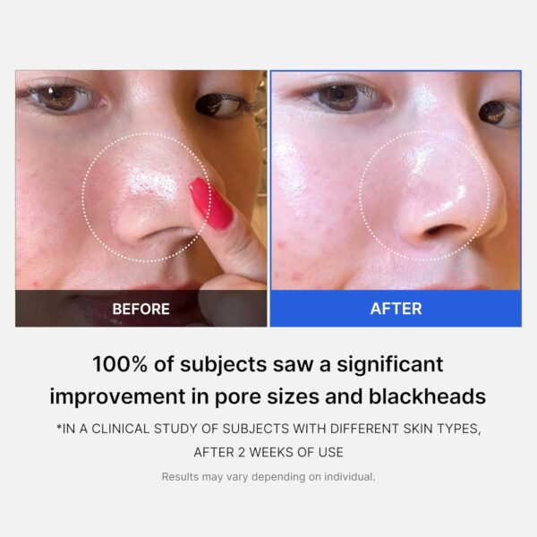 Limited Time Deal 52%OFF! Medicube Zero Pore Pads 2.0, Dual-Textured Facial Toner Pads - Image 5